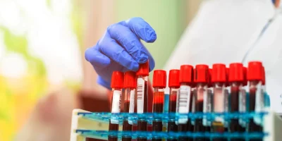 Lab technician organizing blood sample vials